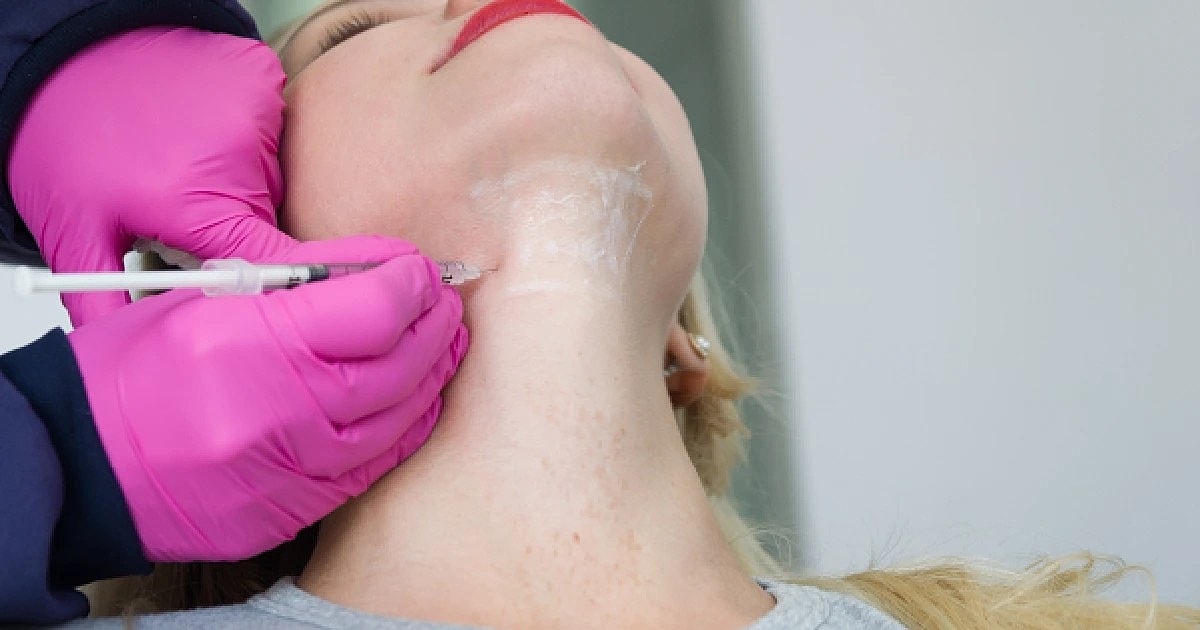 How KYBELLA Helps Improve Your Profile and Facial Contours
